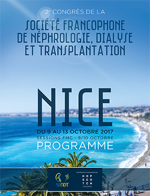 SFNDT Nice 2017