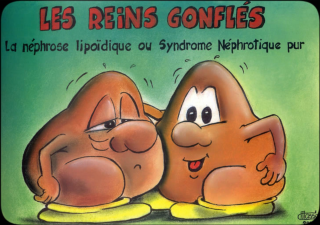 reins-gonflés